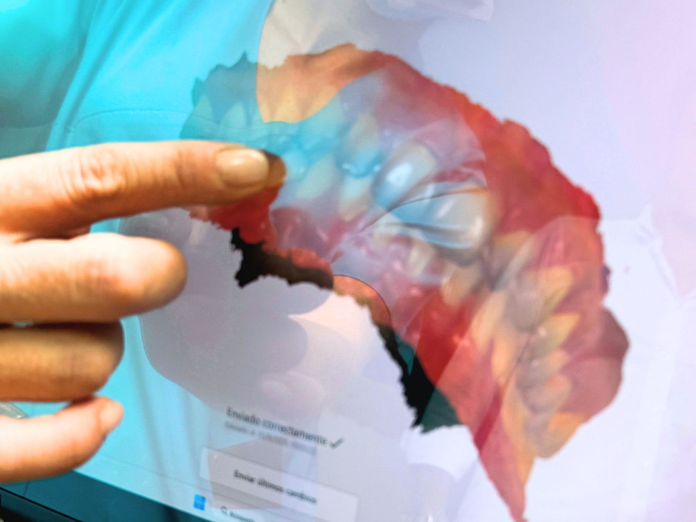 Modelo 3D de una arcada obtenido con el escáner intraoral