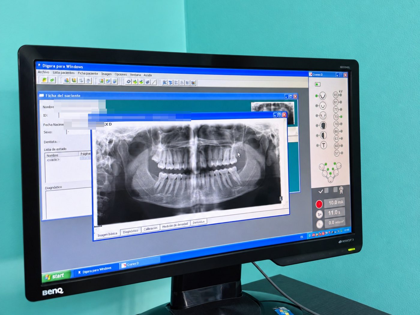 Ortopantomografía digital abierta en el software DIGORA en Clínica Dental 32