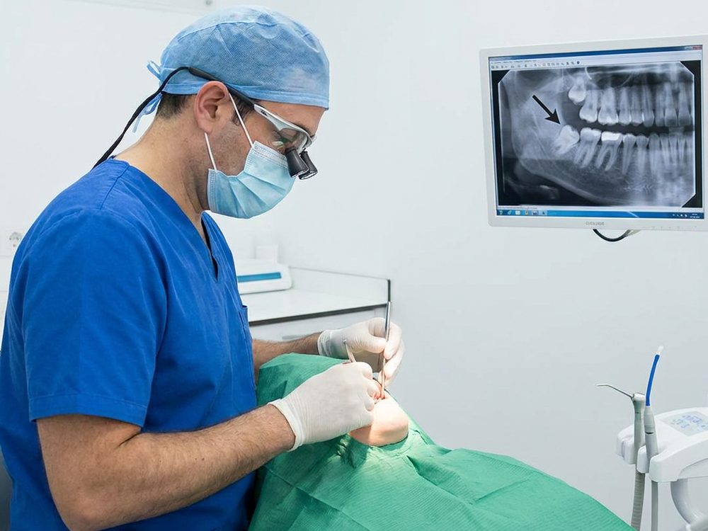 Intervención de cirugía oral con la radiografía panorámica de referencia en pantalla